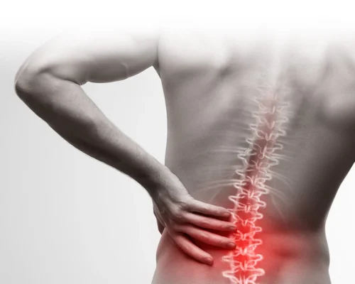 Rethinking Back Pain – It’s Not Just About Posture